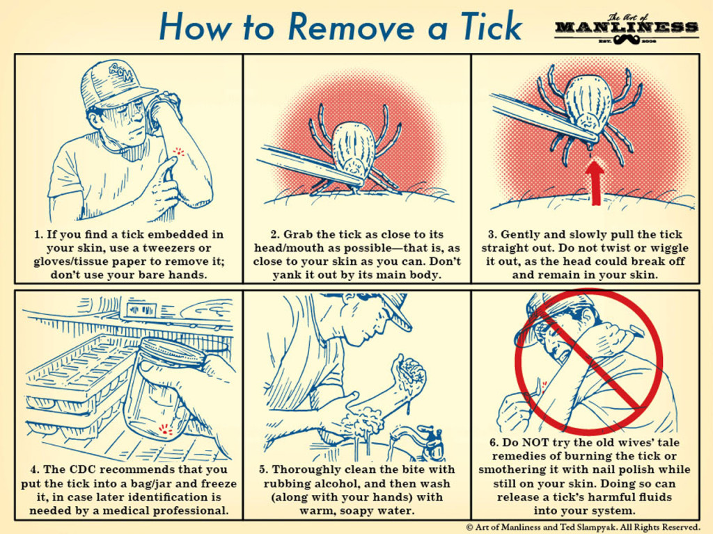 Tick removal facts and fiction 1