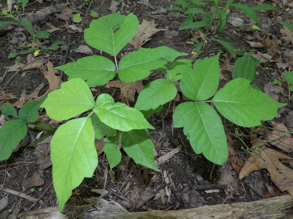 Poison ivy rash 1