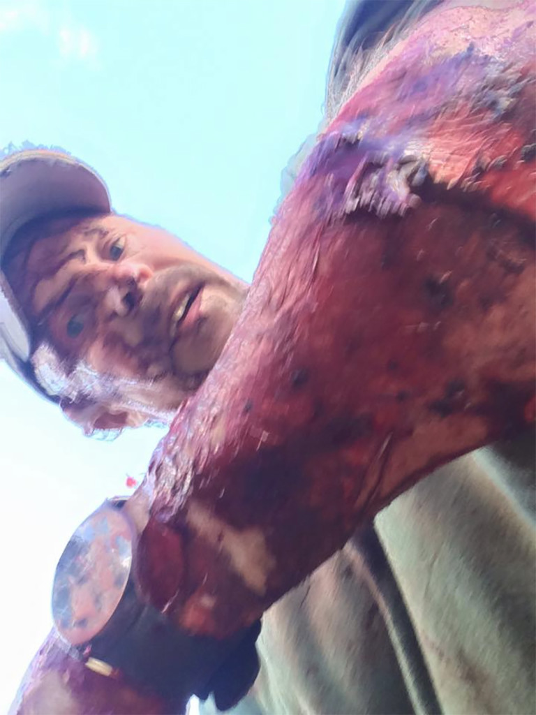 Grizzly bear attack bloody forearm