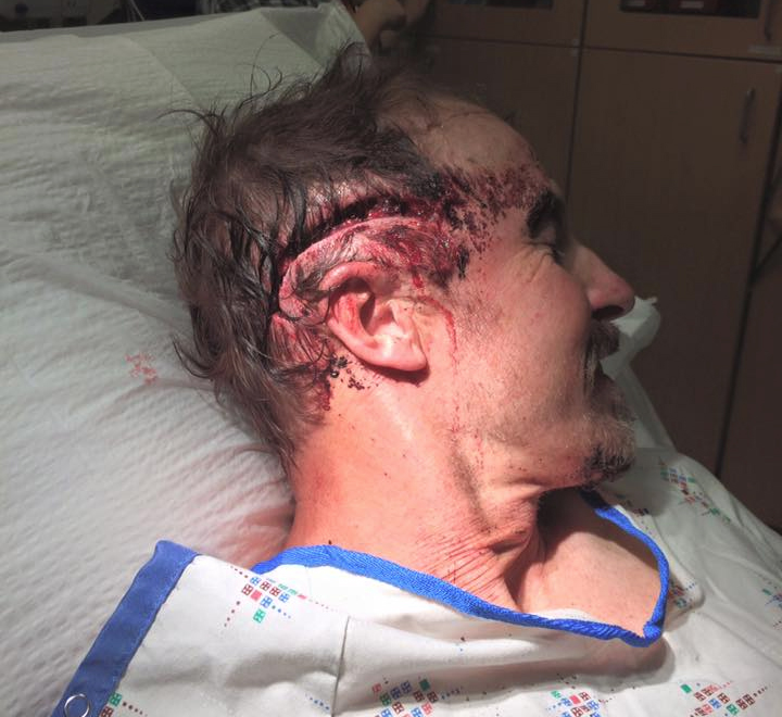 Orr's head wound was treated at a local hospital, and will eventually heal. Source: Todd Orr / Facebook