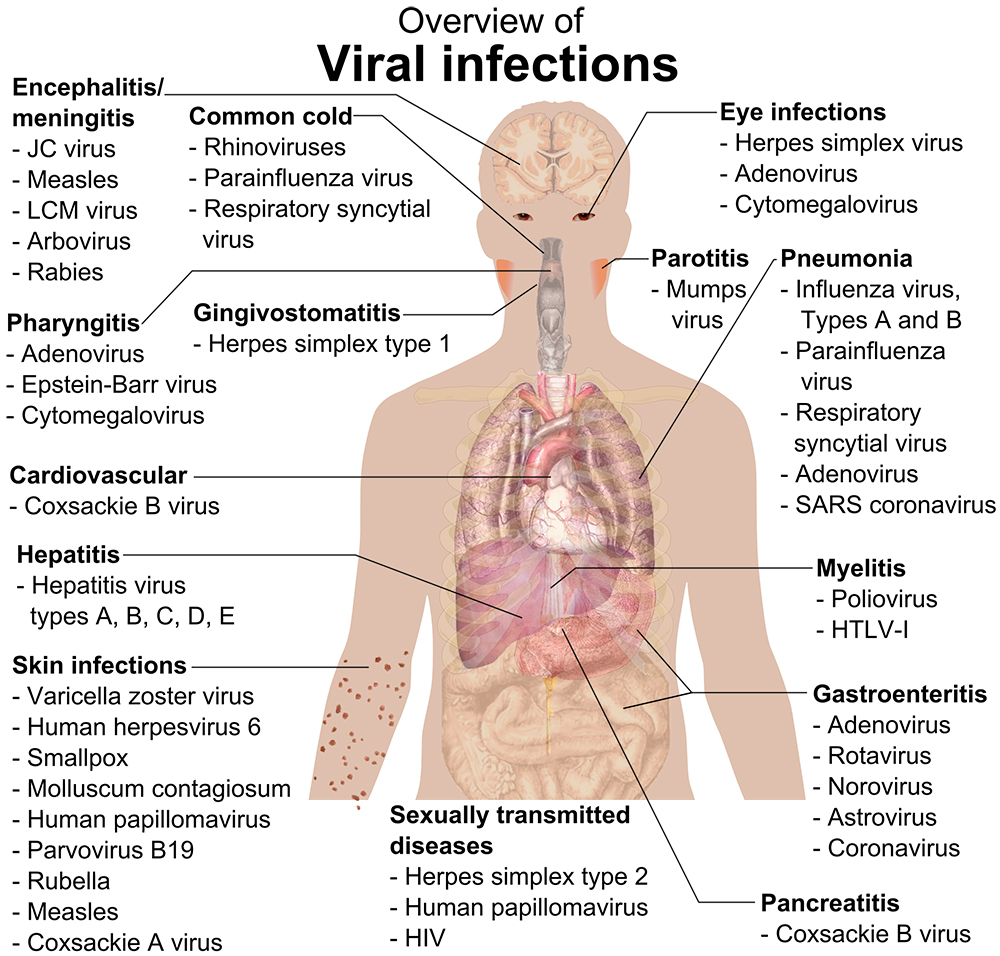 Virus disease flowchart medical first aid infographic 4